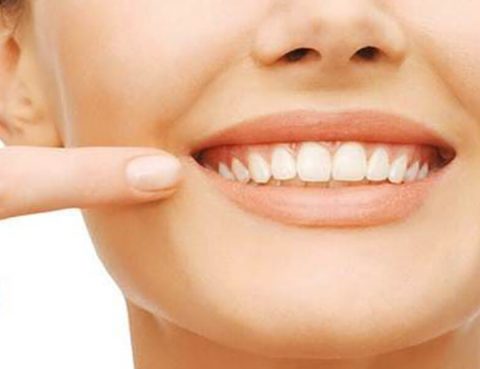 Tips Cegah Gigi Berkarang